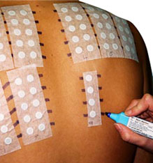Patch testing